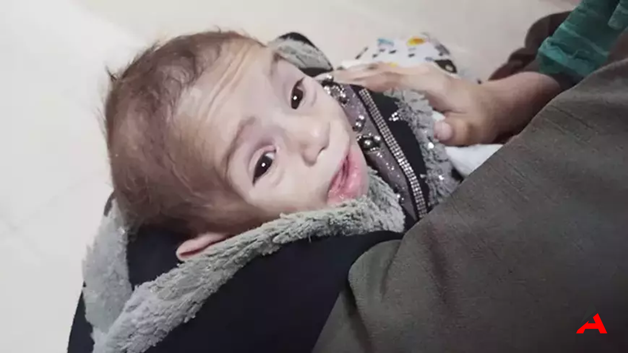 Gazze'de 277 Gün: 38 Bin Ölü, 88 Bin Yaralı