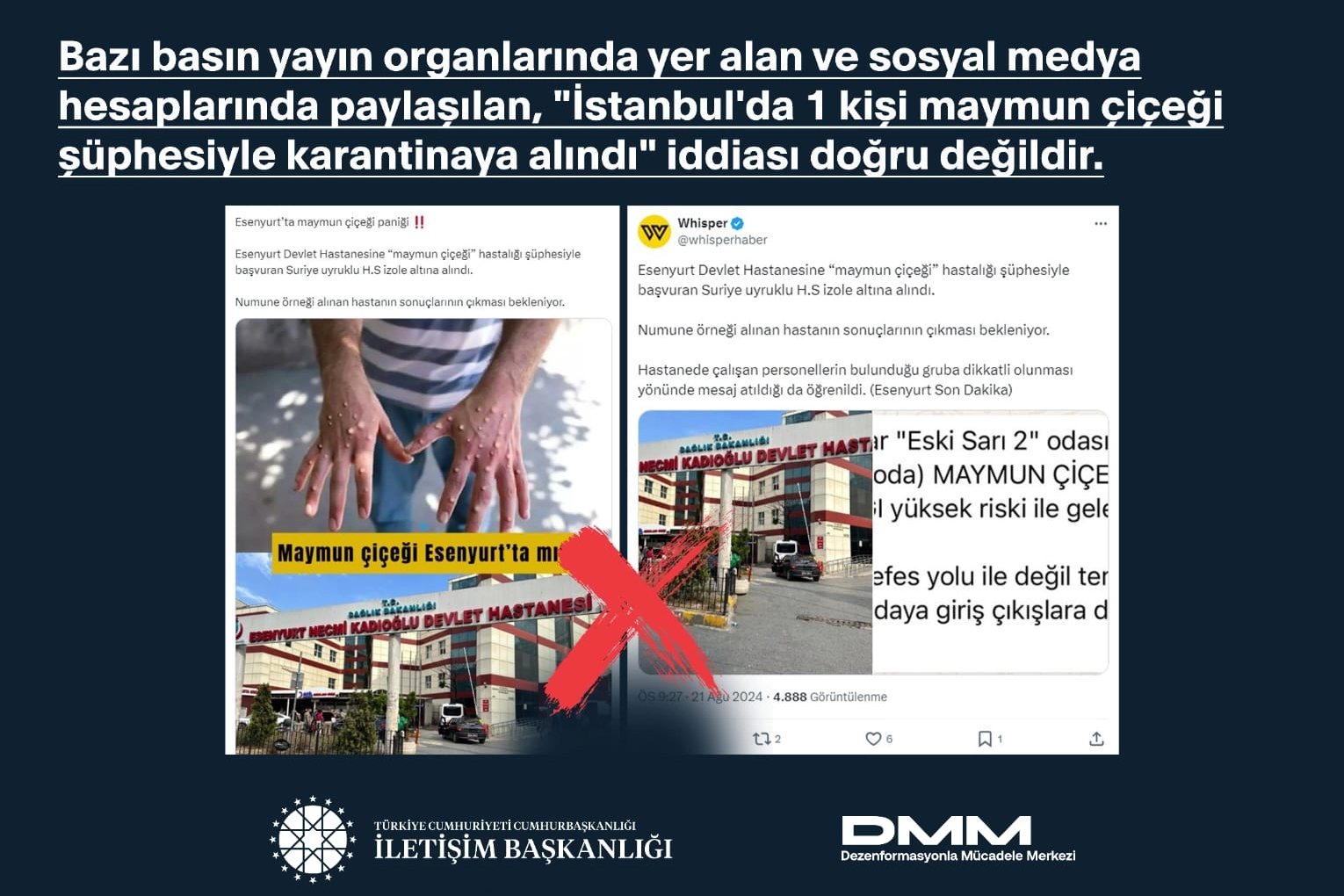 Maymun Çiçeği'nin Türkiye İddiaları Dezenformasyondan İbaret